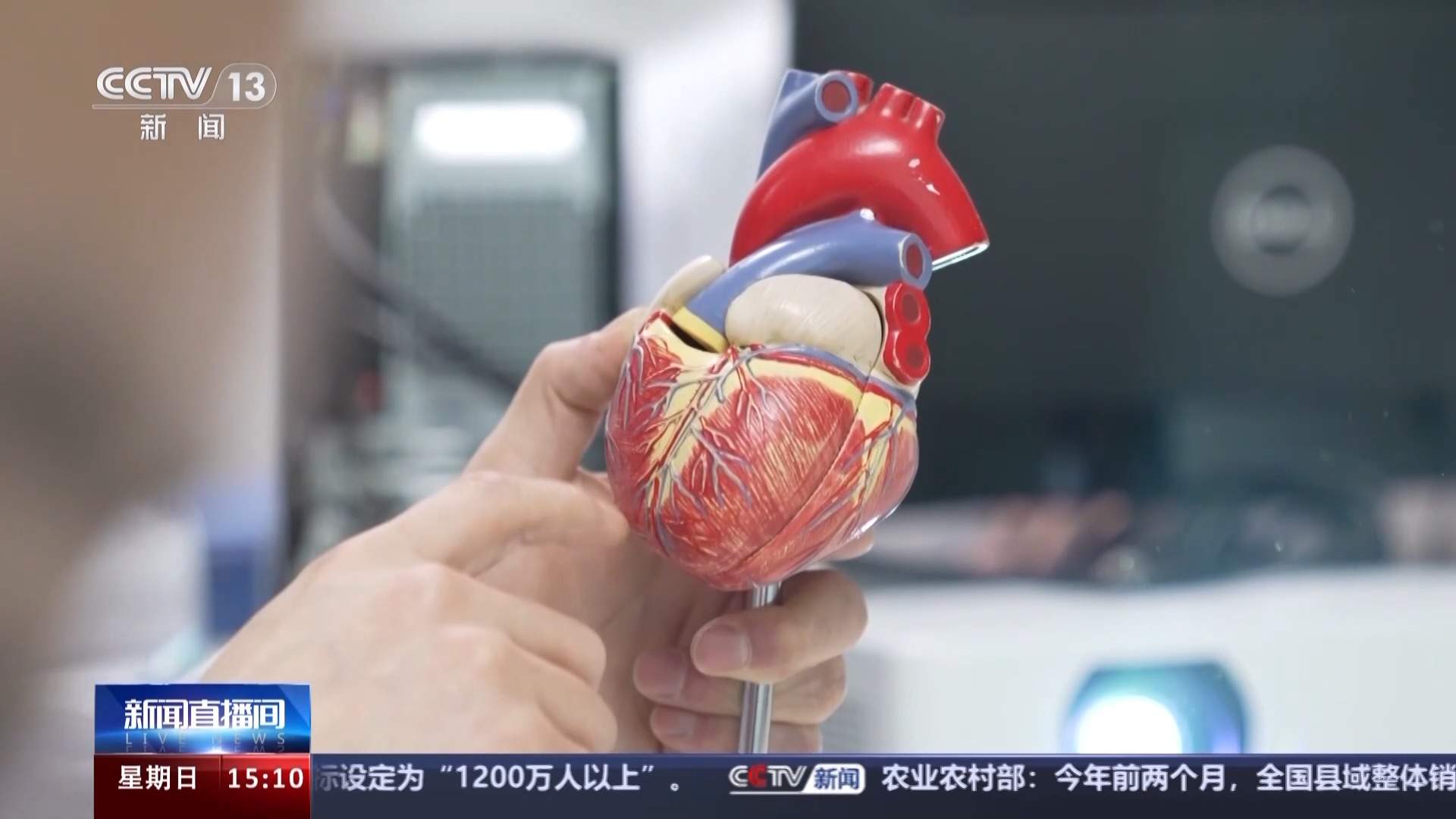 降价不降质 三年来超370万患者用上了集采的心脏支架