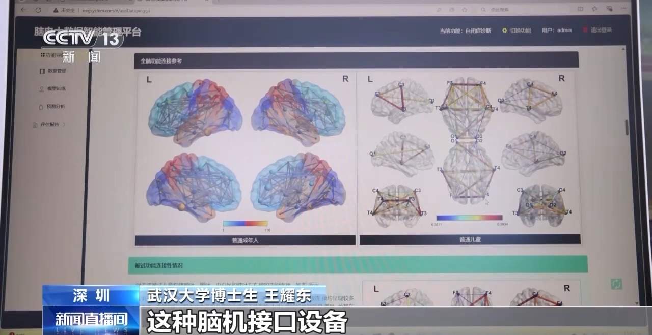 如何捕捉树木生长？玩游戏辅助治疗认知障碍？这届高交会太全面了