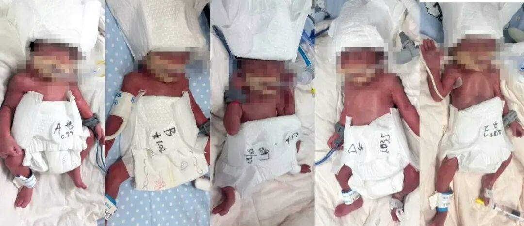 5胞胎（1男4女）顺利出生！母亲恢复良好，宝贝体征稳定