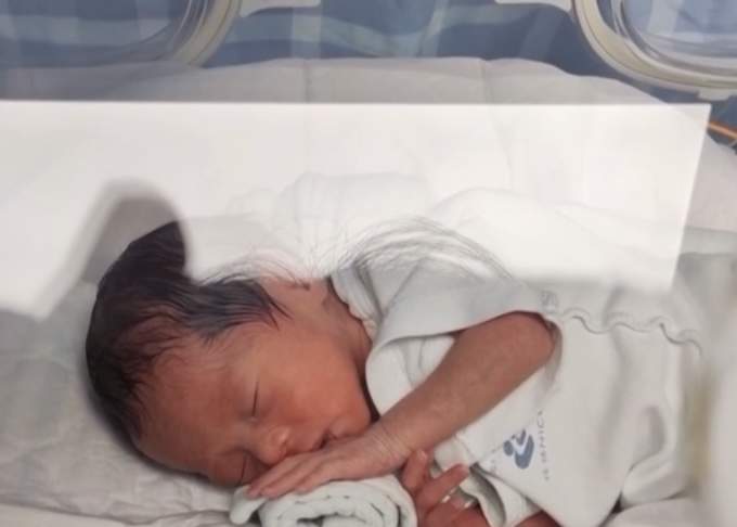 深圳夫妻育两女后再生四胞胎引热议，医生称三胎以上原则建议减胎