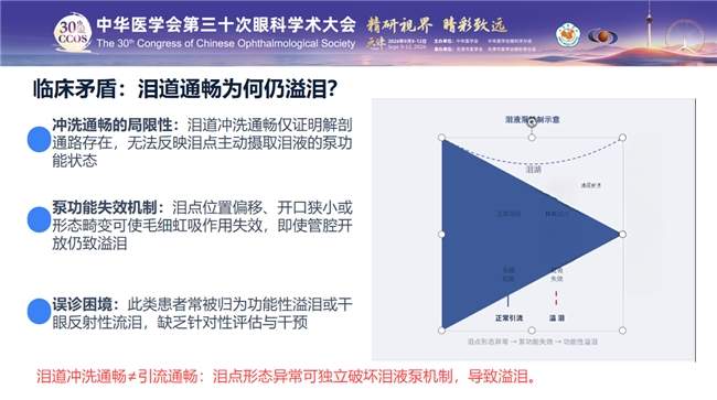 精研泪道微形态 破解顽固益泪——郑州普瑞眼科刘辉主任受邀出席中华医学会第三十次眼科学术大会并作专题发言