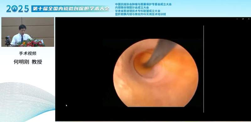 荣耀时刻：四川结石病医院肝胆外科何明刚主任荣膺全国保胆分会常委