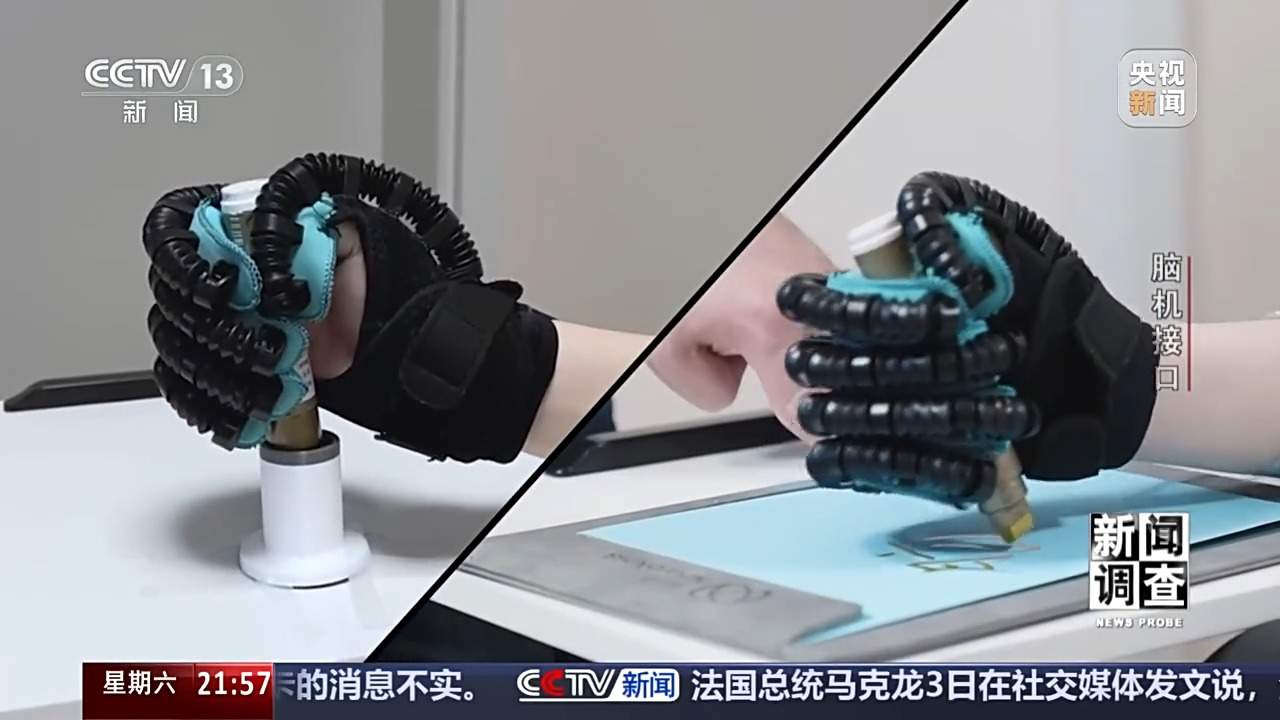 从科幻走向现实 脑机接口技术帮助患者“接”入未来