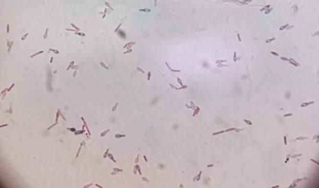 真空包装不是“安全袋”！看完赶紧查冰箱