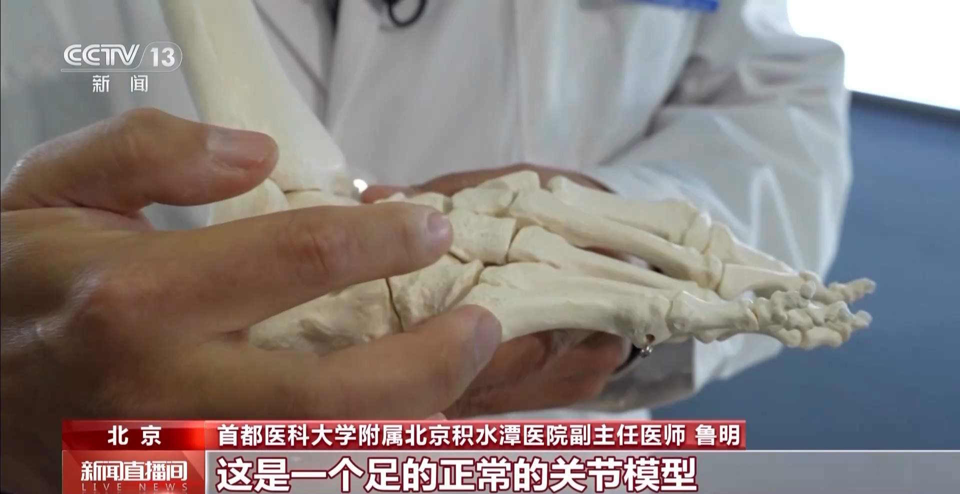 疯狂种草碳板跑鞋？医生：足底筋膜炎警告！