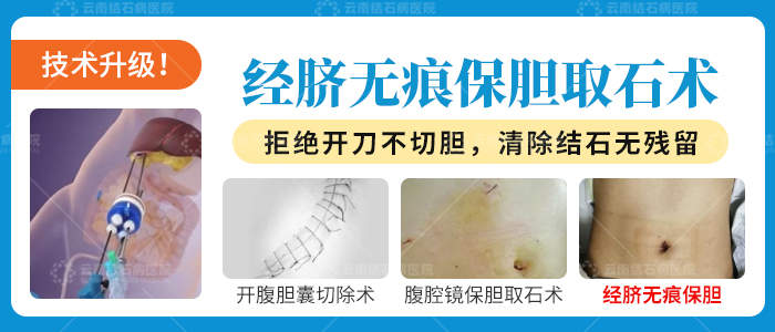 从质疑到赞誉：云南结石病医院如何打消重庆患者保胆疑虑