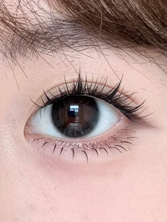 眼整形技术研讨会在榕举办，福州海峡薛克墘：双眼皮定制，切勿照搬网红模板