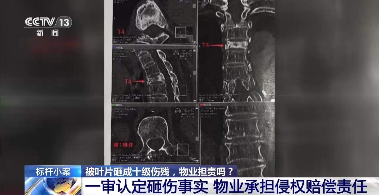 老人小区内遛弯被大王椰叶片砸成十级伤残 物业要担责吗？