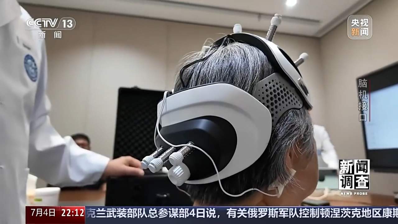 从科幻走向现实 脑机接口技术帮助患者“接”入未来