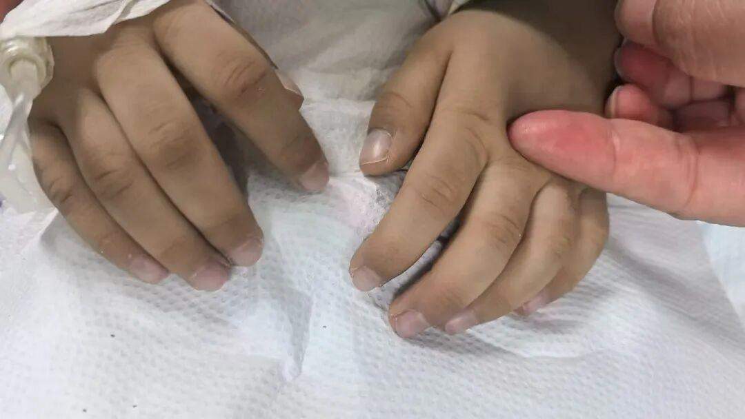 男童长期吃隔夜菜脸色发青 老师坚持送医救了一命……