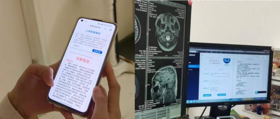 不到1秒就能提供正确诊断这个小君医生如何724小时不间断工作