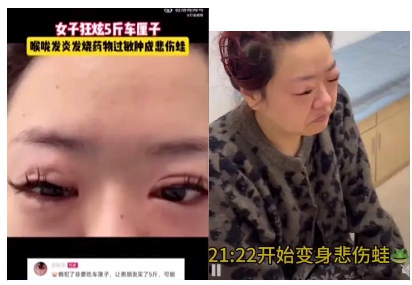 价格大跌！有人“狂炫”5斤后发烧、进抢救室！医生提醒