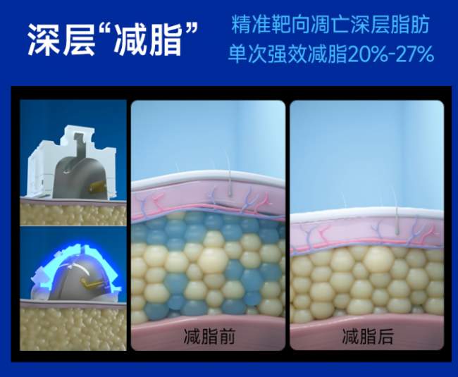 别再盲目减脂了！越瘦越丑的真相，90%的人都踩坑
