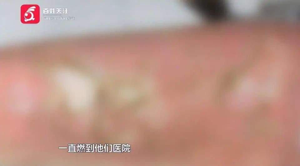 别碰！从水里捡到的“漂亮石头”竟会自燃