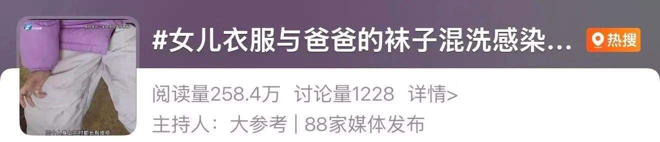 全家衣物混洗致8岁娃“中招”花斑癣！科学洗衣注意这几点