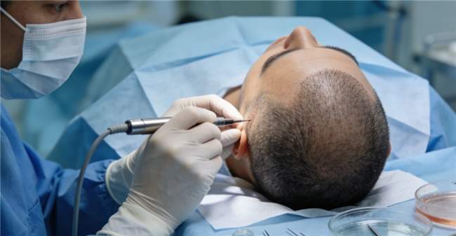 春季植发正当时：雍禾医疗好医生体系一体化诊疗引领行业新趋势