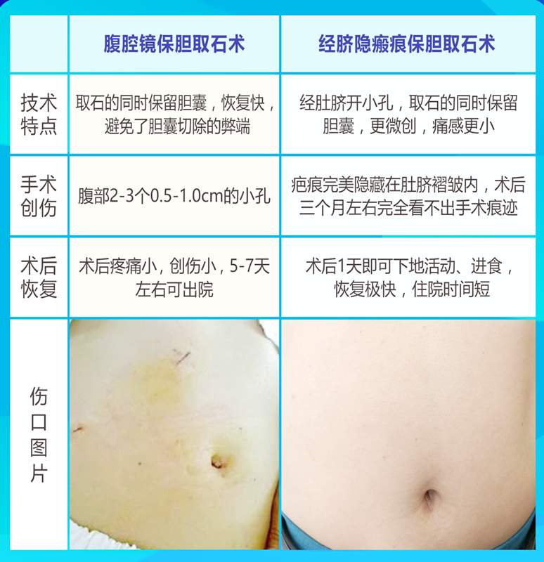 一束鲜花表谢意，一份信赖寄四川结石病医院！八年结石，患者隐痕保胆终遂心 - 商业 - 科智网 